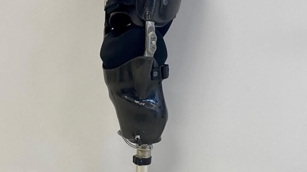 Prosthetic Limb Socket