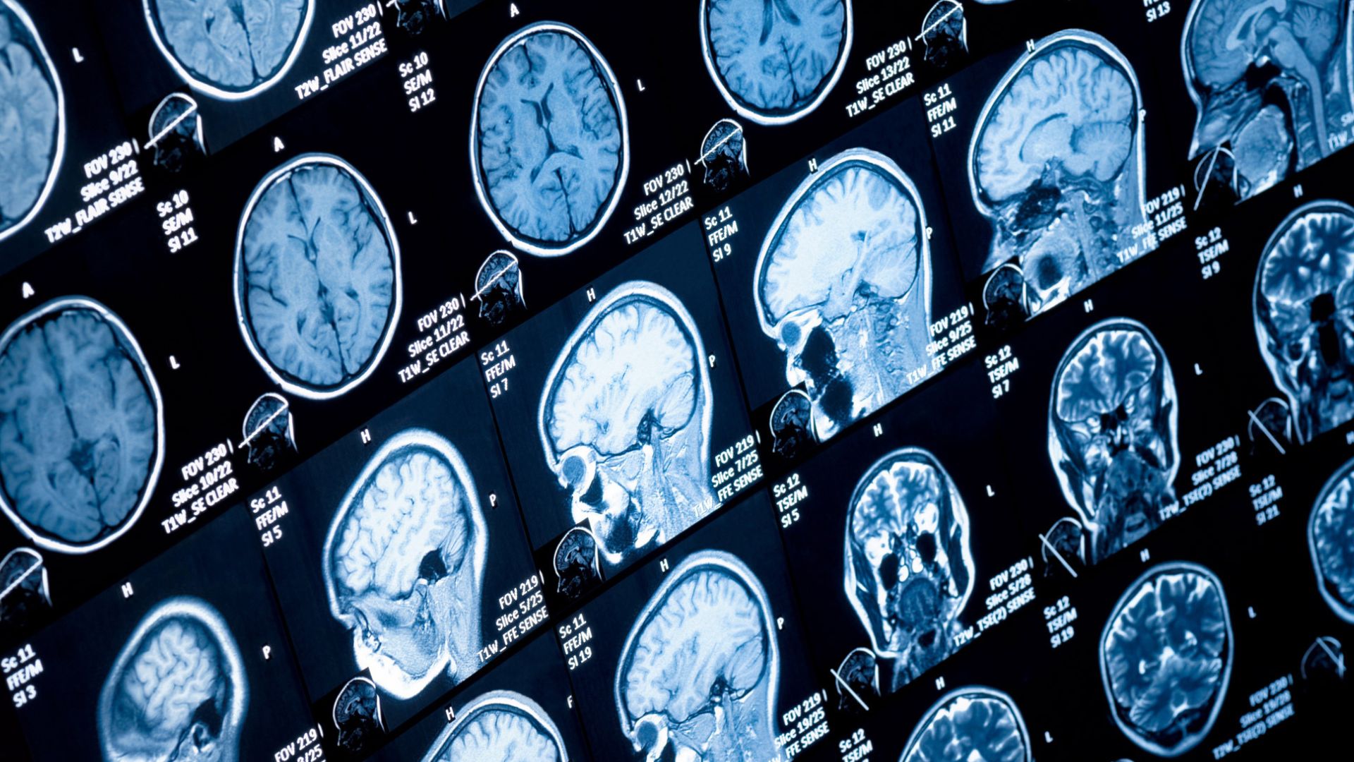 surgical robot, Brain Imaging