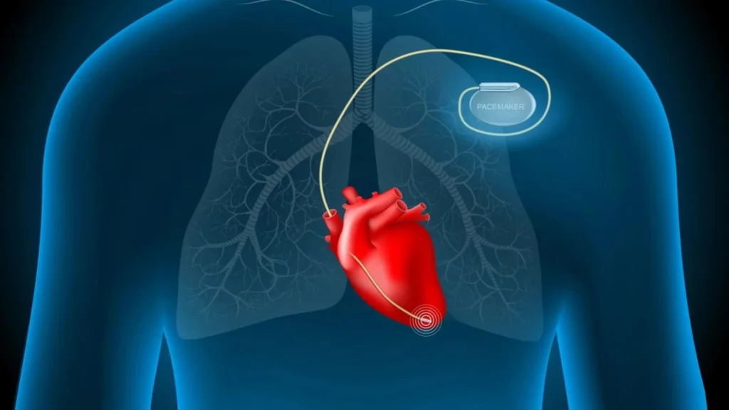 China Creates Lab-Grown Human Heart Pacemaker Tissue