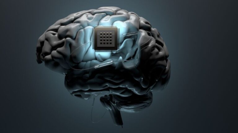 Brain Chip