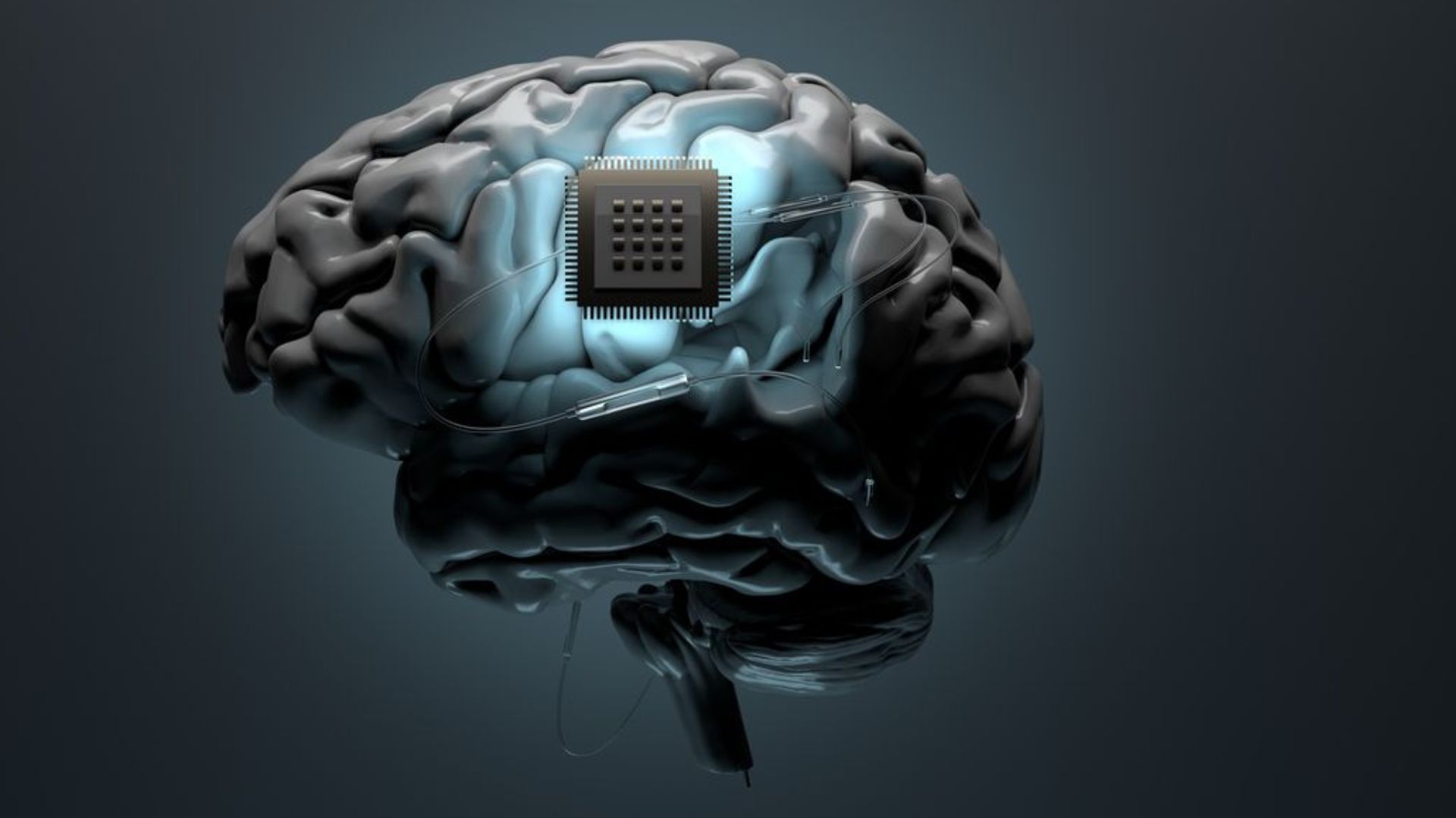 Brain Chip