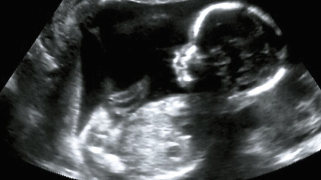 Chinese Doctors Use Microwave Needle To Shrink Lung Tumour In Unborn Baby