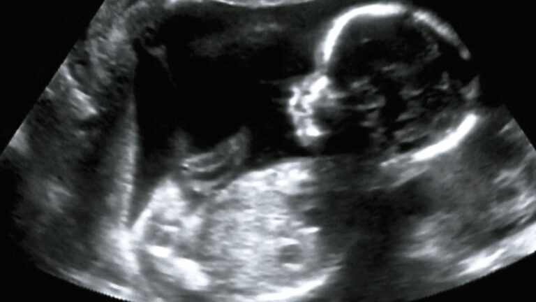 Chinese Doctors Use Microwave Needle To Shrink Lung Tumour In Unborn Baby